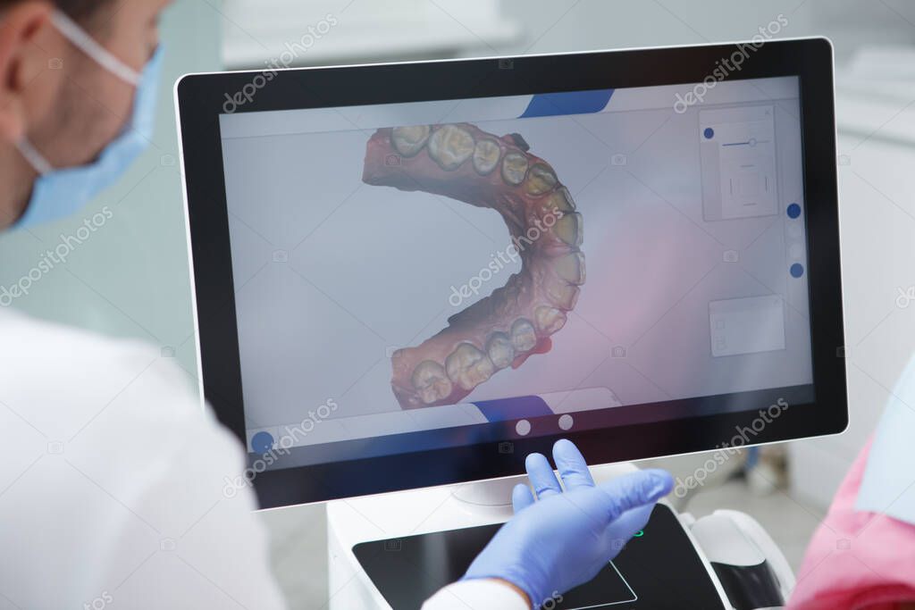 Scanner intraorale in uso